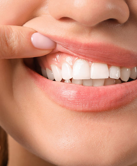Close up of a person pointing to their gums
