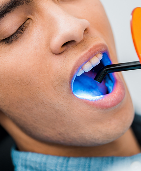Close up of a dental patient having an ultraviolet light applied to their tooth