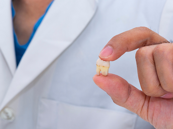 Dentist holding an extracted tooth